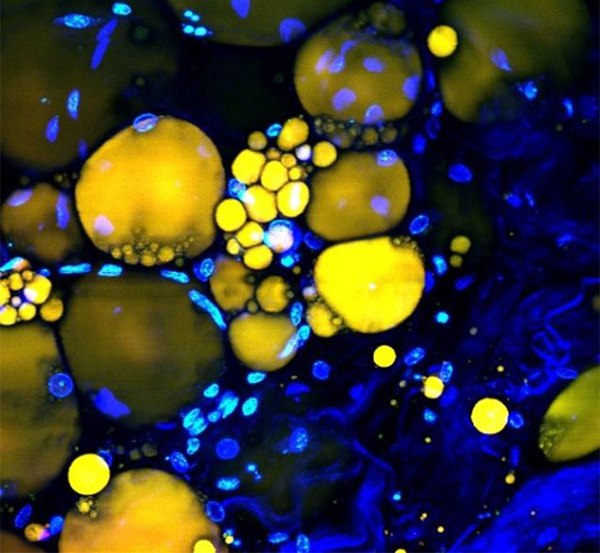 ساخت لیزر از سلول های انسان2