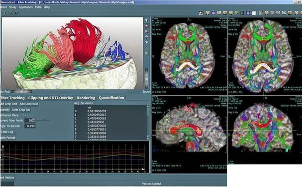 چاپ سه بعدی MRI