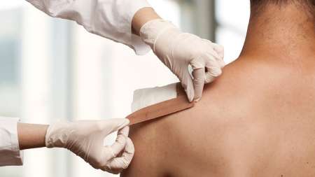 پانسمان الکتریکی جایگزین آنتی بیوتیک