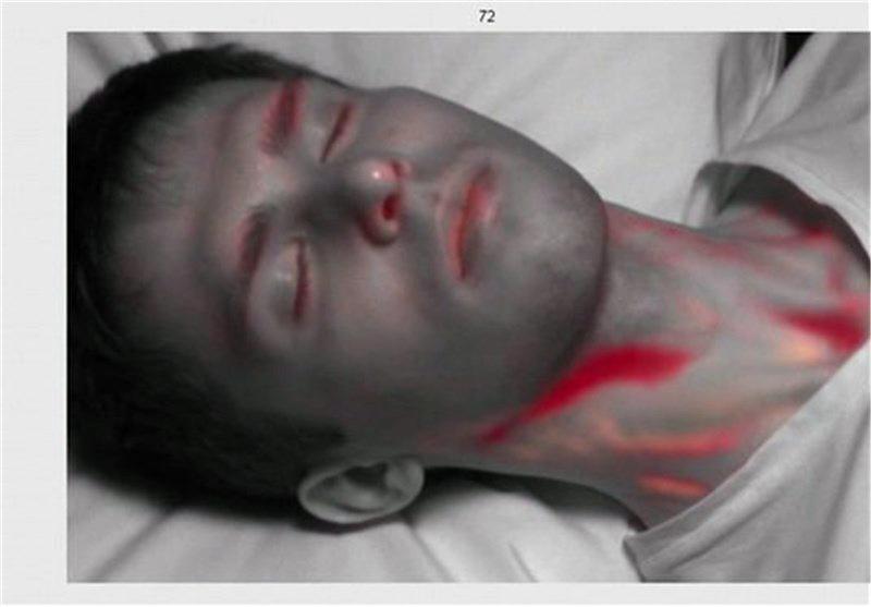 تصاویر گردش خون