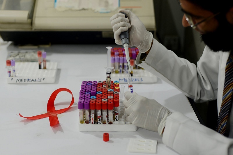 درمان قطعی HIV در راهست