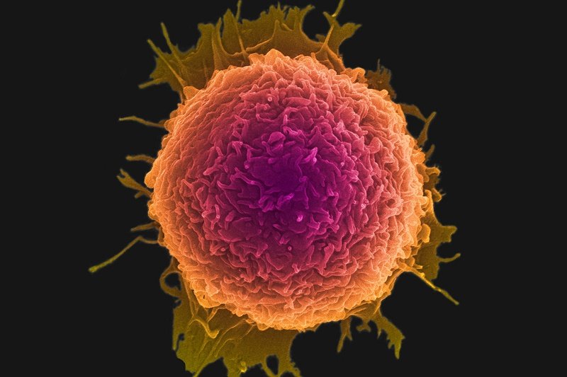 درمان سرطان با نانودیسکها