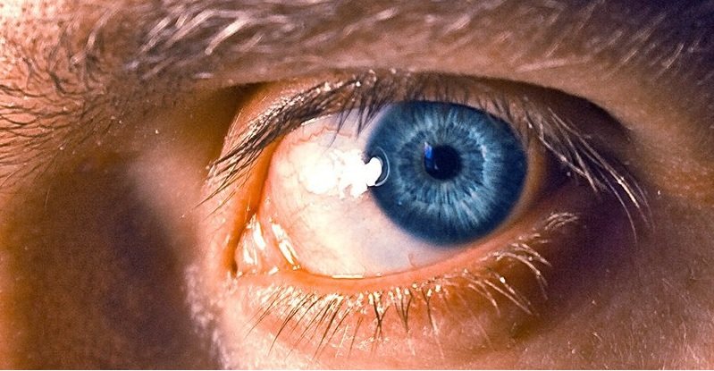 چشم ها و توهم بصری