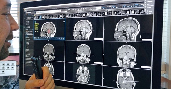 کمک ابرکامپیوتر واتسون IBM به پزشکان